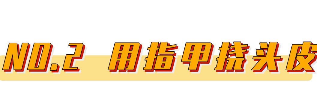 护发防秃头,秃头困扰这四个护发雷区要警惕