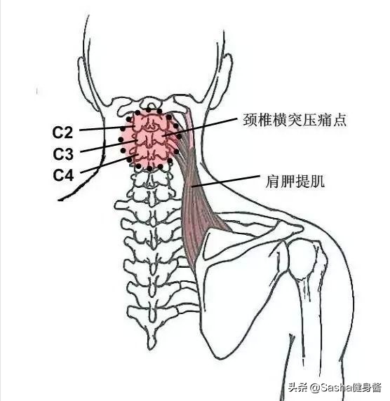 全身肌肉都痛是怎么回事,全身肌肉痛是什么病