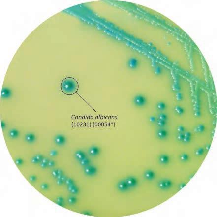 显色培养基教程,显色培养基用途