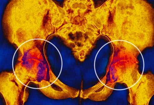 身体有病胯骨先知,身体有病双腿先知