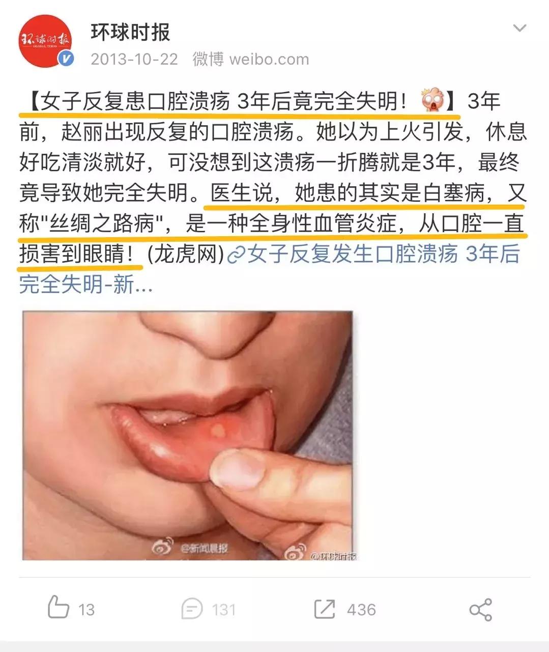 嘴上长了一个巨大的口腔溃疡,嘴皮上长了个口腔溃疡
