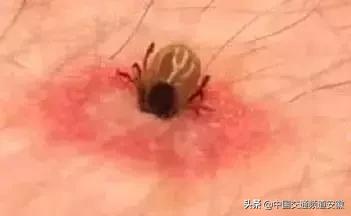 安医大二附院最新消息今天,安医大二附院住院部最新消息