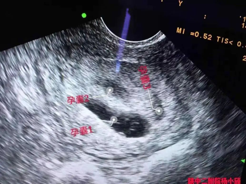 陕西中医药大学附属医院生殖科,中医药大学附属第二医院生殖中心