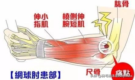 网球肘的自我锻炼三个动作,一个动作解决网球肘