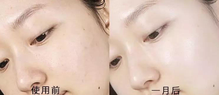 笑我用30块的水乳太便宜？但它护肤效果堪比磨皮美白！
