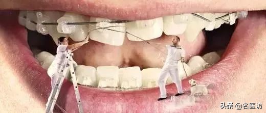 2020牙齿矫正攻略请查收,今日头条修复牙齿