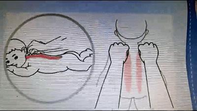 儿童一直咳咳咳怎么缓解,小孩久咳不止夜咳一招根除