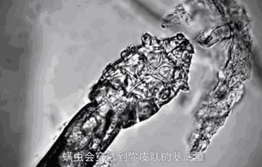 男女通用苦参净螨皂补水效果好吗,苦参皂一款全家都能用的万能皂