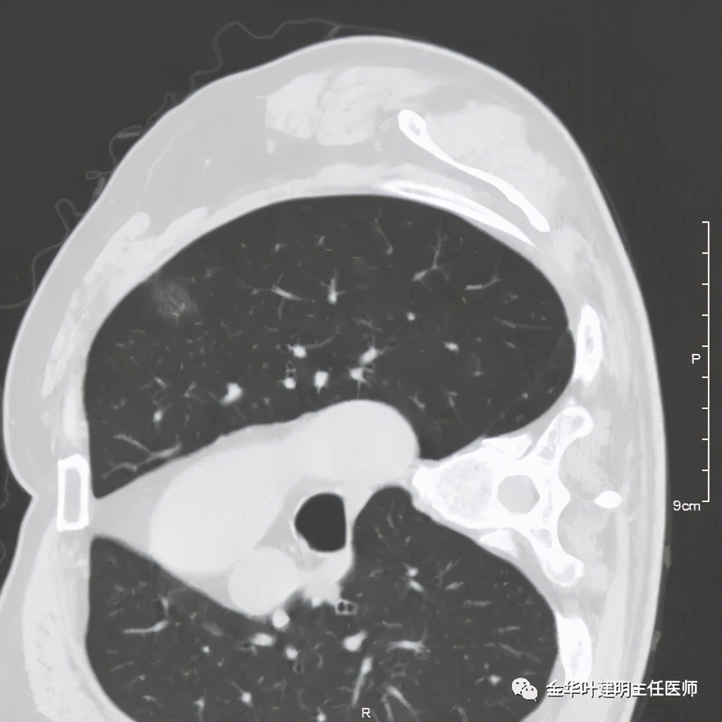 放个大招完整版教学,放个大招完整版前奏