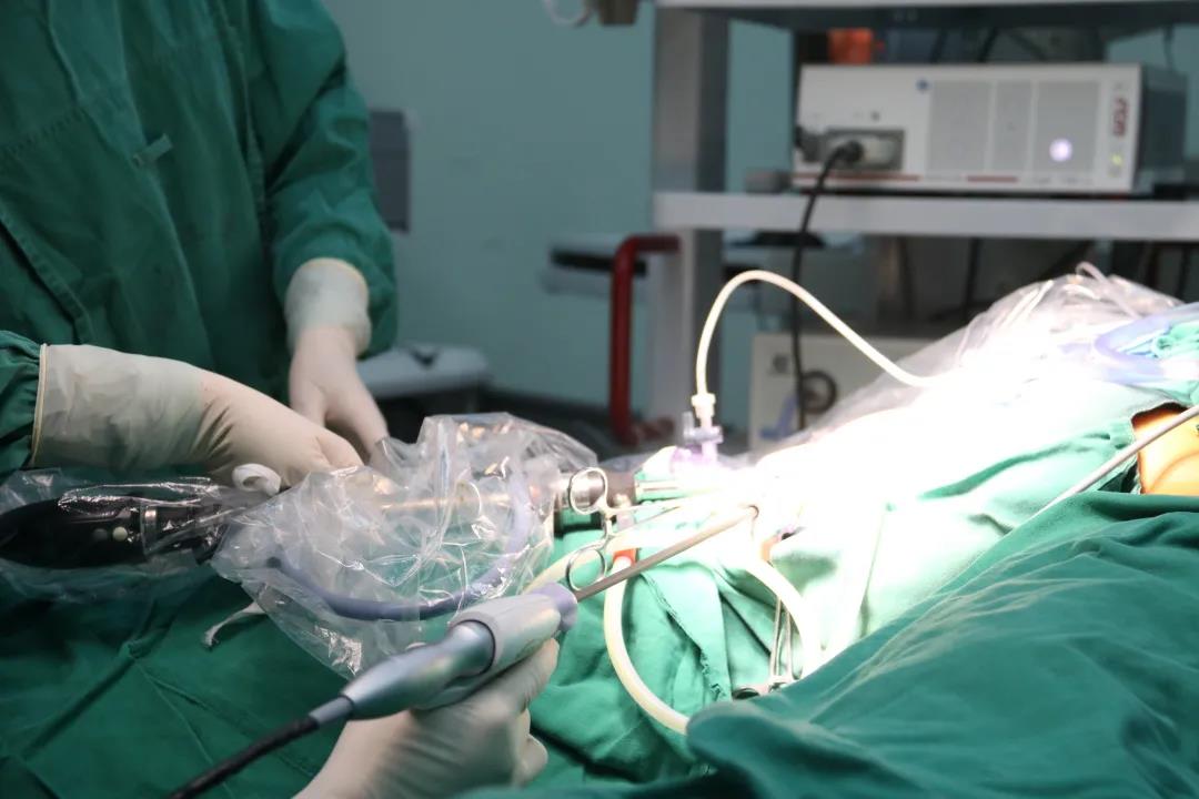 无症状瘙痒可能会是什么癌,肝癌的早期症状及表现皮肤瘙痒