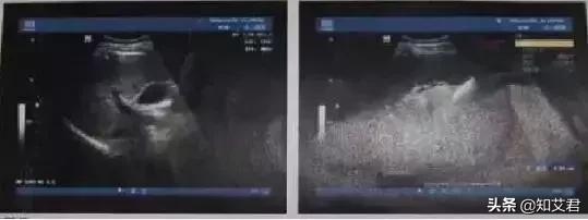 不属于艾滋病高危人群的是,不属于艾滋病病毒感染的高危人群