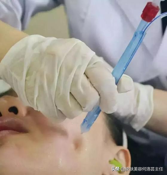 无针水光涂抹式,注射式