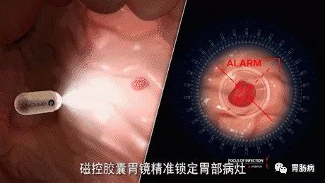 做胃镜怎样配合医生才不感觉痛苦,做胃镜的医生说不严重靠谱吗