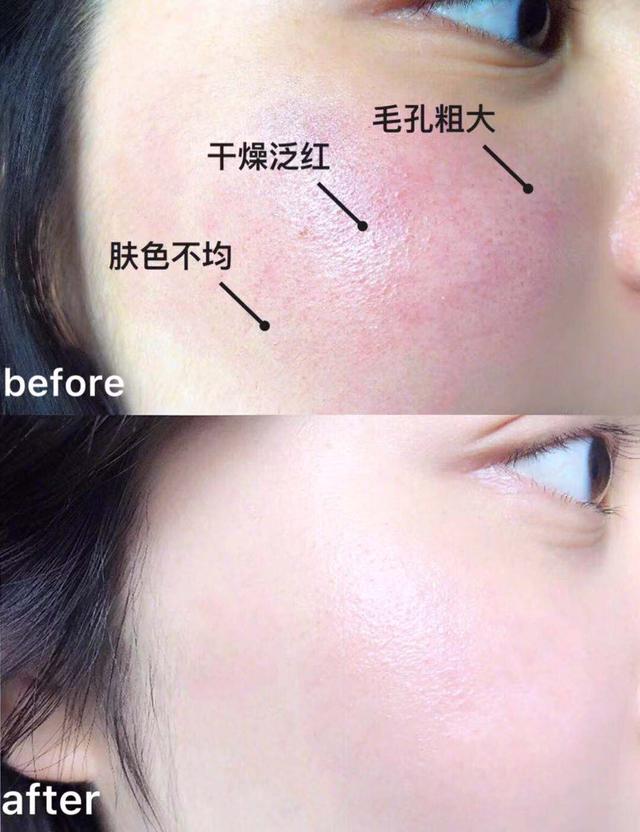 敏感肌30秒自测,敏感肌全套护肤推荐