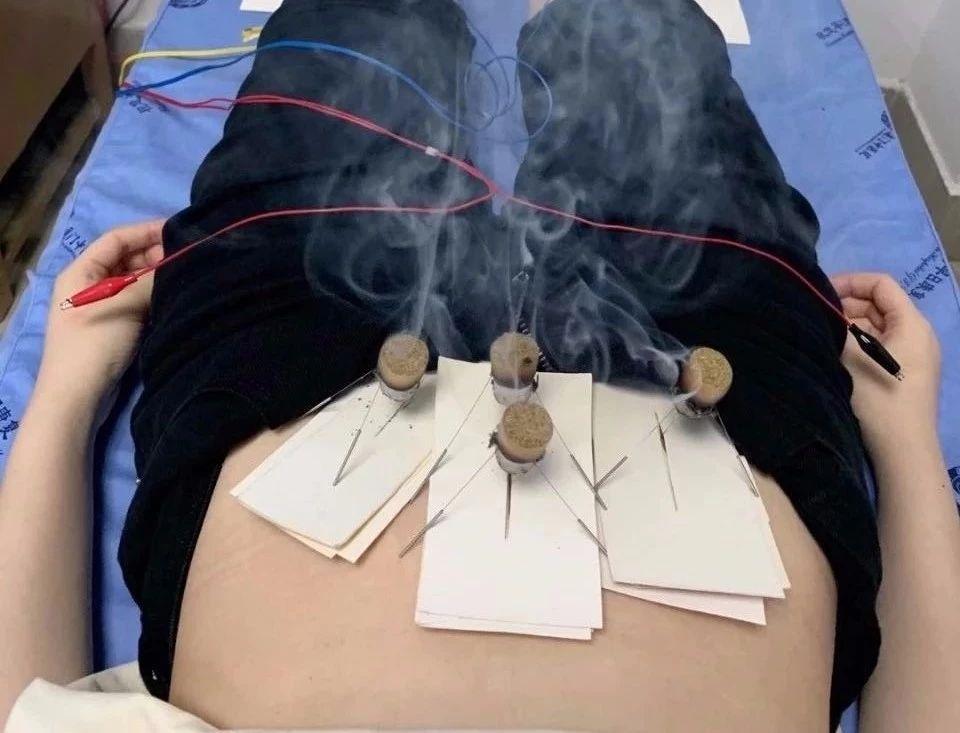 肩背部内侧疼痛康复方法,颈肩椎疼痛康复治疗