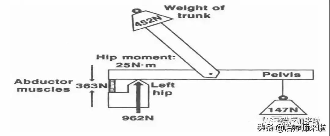 常见的异常步态醉酒步态,步态异常的十大特征有哪些图片