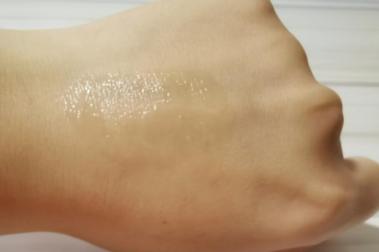 夏季蚊虫咬留疤怎么办,夏天蚊虫叮咬的疤会留白印吗