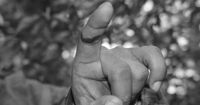 因为吃饭咬破嘴，这位大叔在ICU住了28天