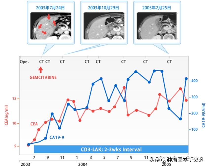 全世界治疗癌症的药物,日本癌细胞免疫疗法