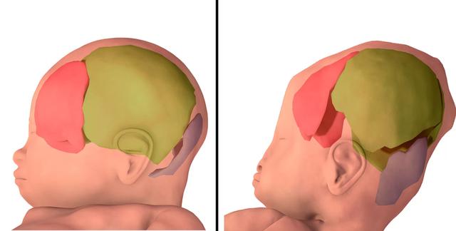 婴儿出生时承受巨大挤压，3D图像显示了挤压程度！