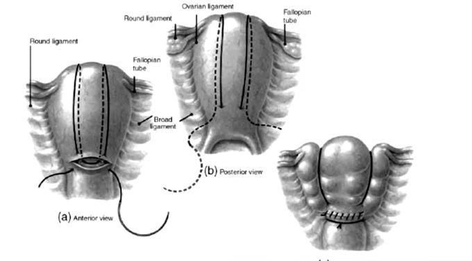 有利于预防产后出血的措施有,羊产后出血治疗土办法