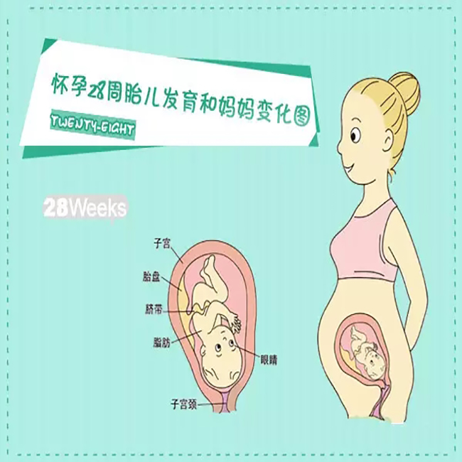 29周孕妈妈臀位怎么能纠正过来,怀孕28周臀位绕颈一周可以做吗