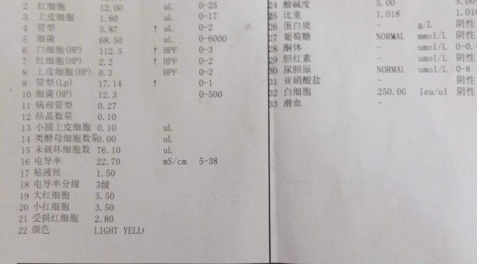 十月怀胎甚是不易,怀孕产检为什么每次都要尿检