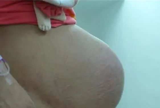 孕晚期肚子下坠是怀的儿子,孕晚期肚子下降了是入盆了吗