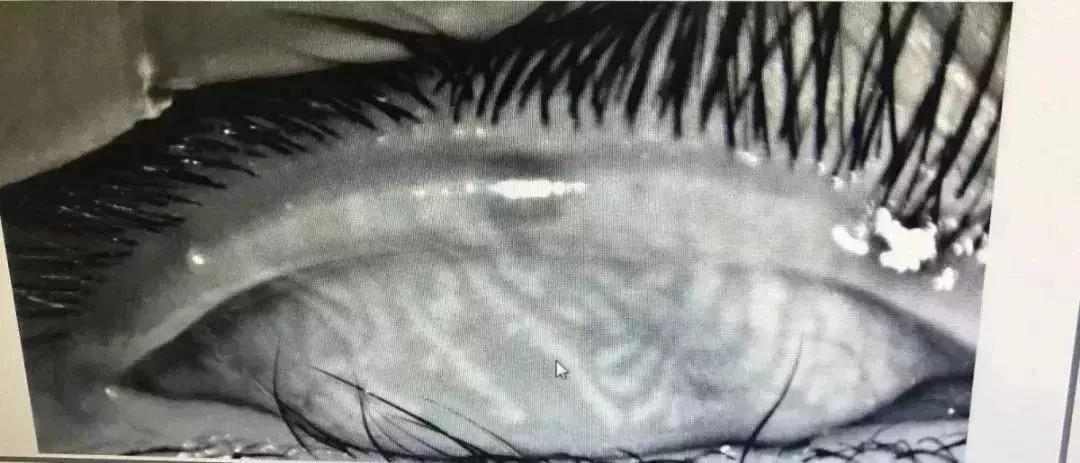 家长急死!11岁男生经常躲被窝里干这事!医生:已无法彻底恢复!