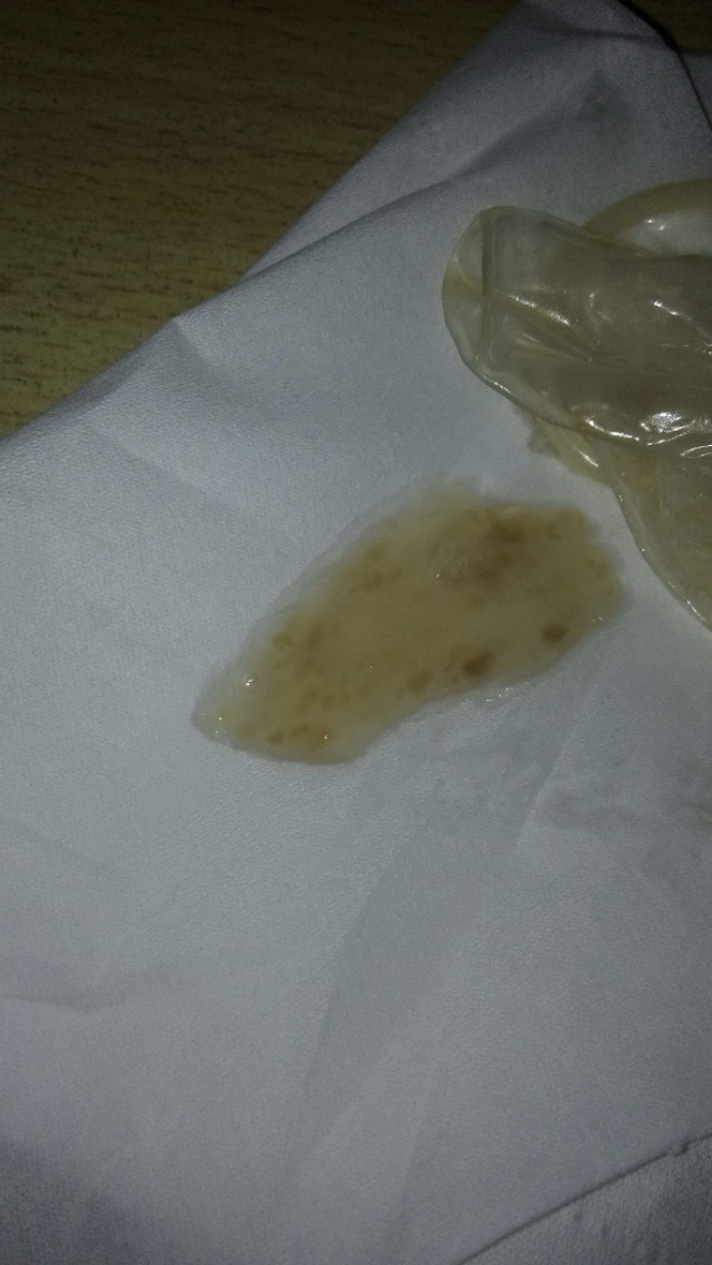 精子质量检测深度学习,精子质量检测怎么做