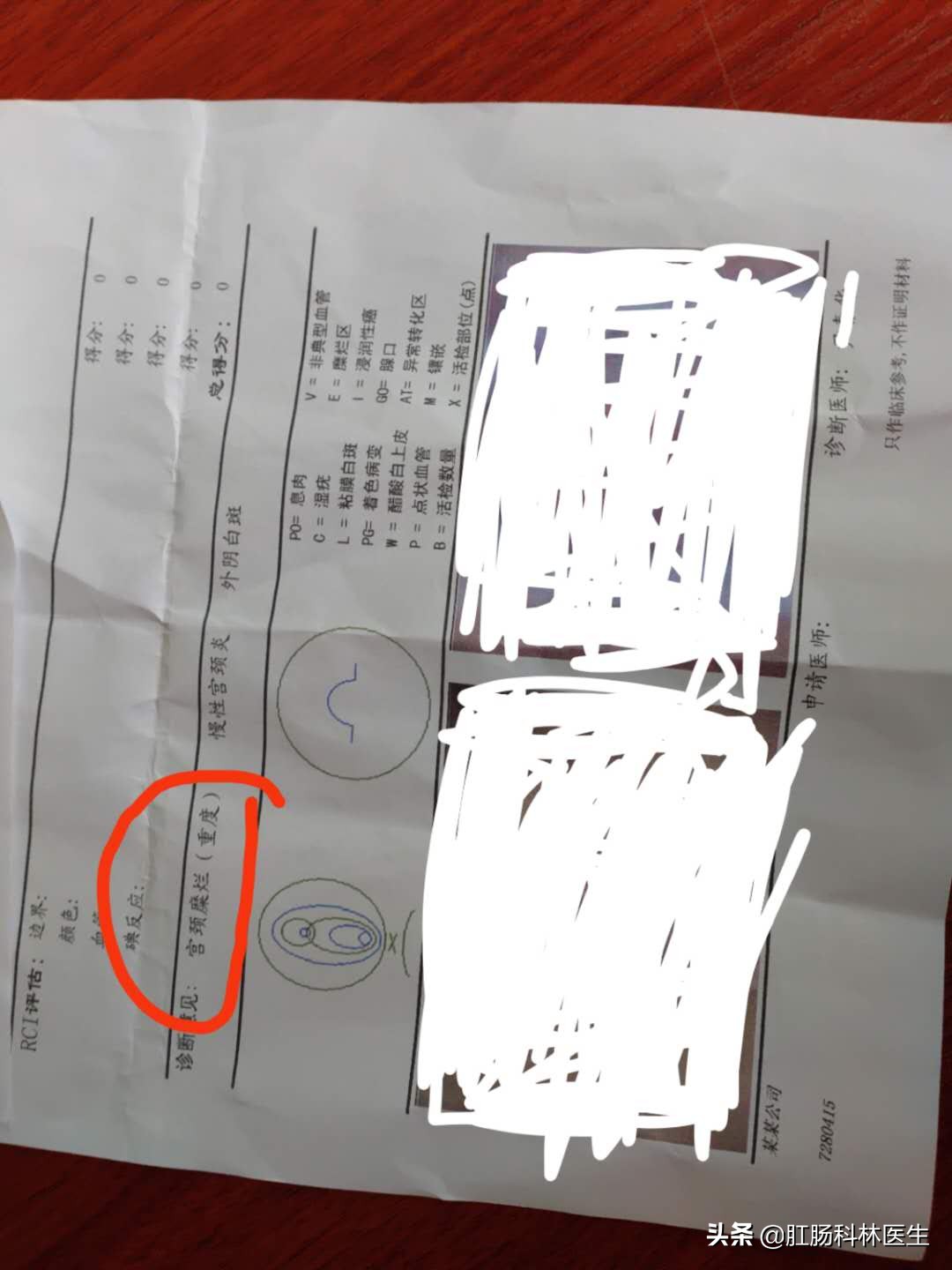 宫颈糜烂到底算疾病吗?为什么医生一定要我做手术