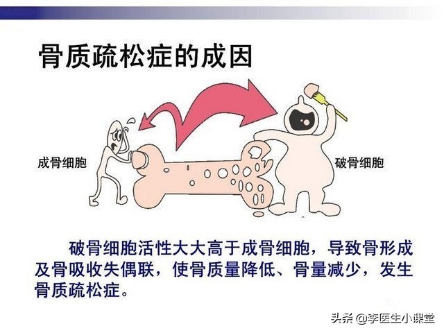 更年期女性疼痛用什么办法解决,50岁更年期全身疼痛怎么回事