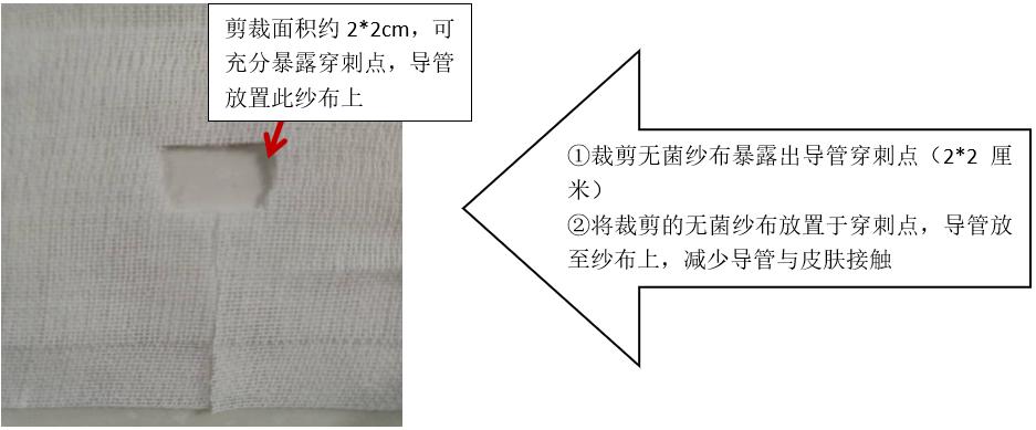 picc敷贴旁边长了小水泡,picc导管贴膜维护教学视频
