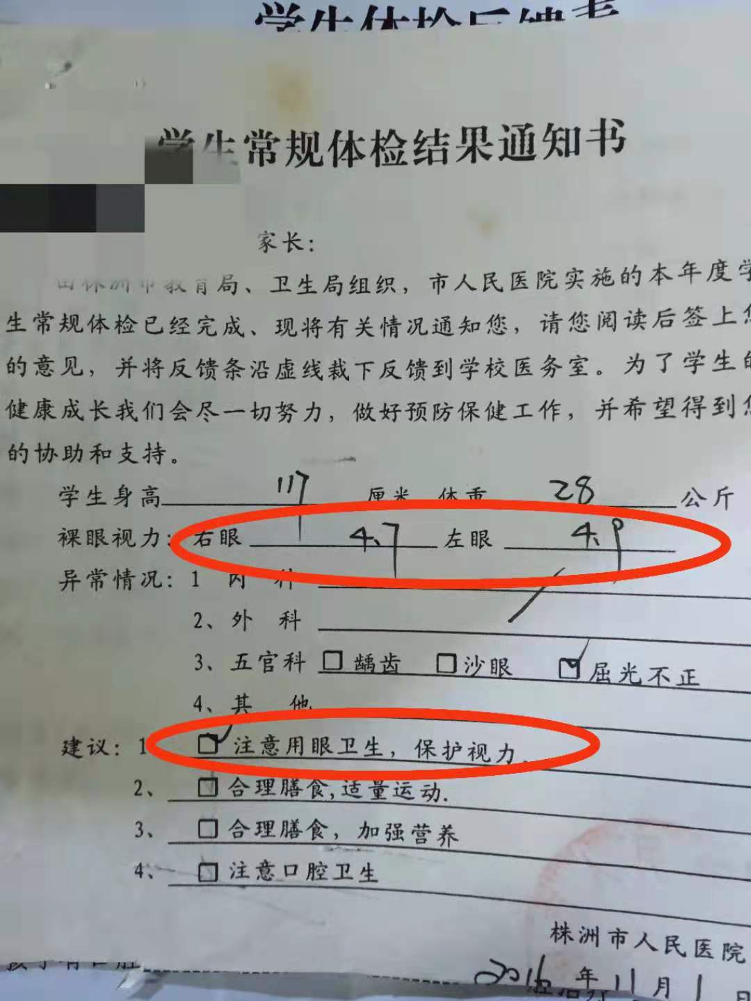 小孩子近视了一定要戴眼镜吗,小孩近视一定要戴眼镜吗