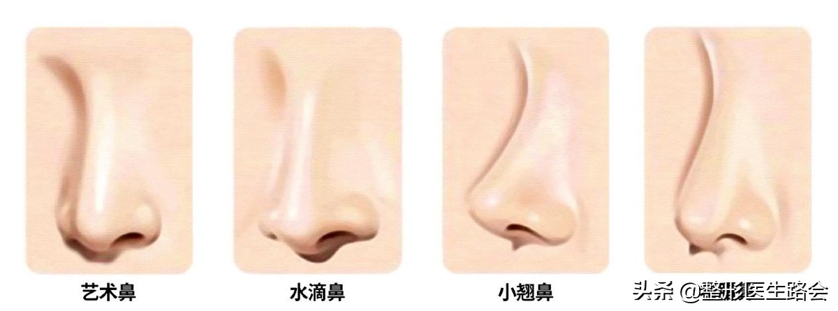 为什么耳软骨只能垫鼻尖不能隆鼻,肋软骨隆鼻时间久了会顶破鼻尖吗