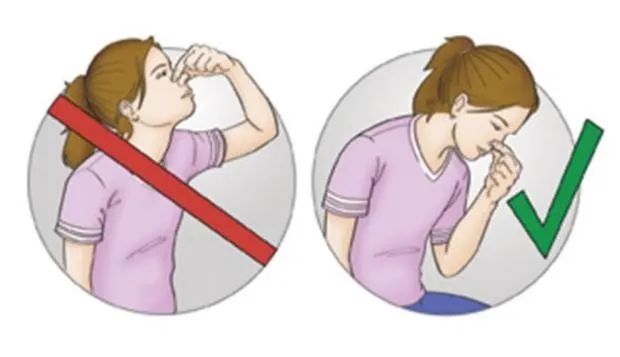 四岁男童夜里鼻子流血都干了,四岁男童左边鼻子出血