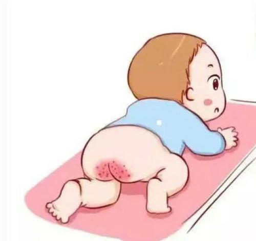 氧化锌软膏宝宝能用吗,氧化锌软膏属于抗生素类吗