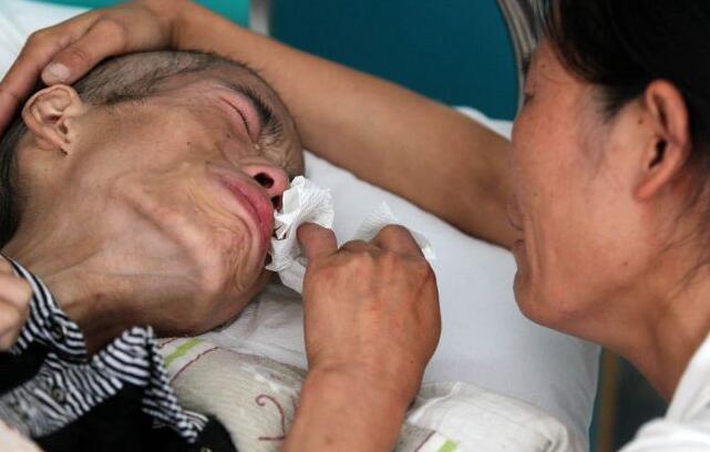 免疫治疗：控制癌症进展缓解癌痛及其它疗法治疗性疼痛