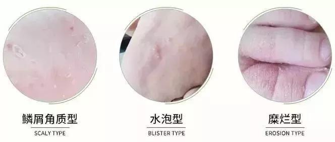 “脚臭”导致不敢脱鞋？黑科技鞋袜除味喷雾，从此让你自信脱鞋