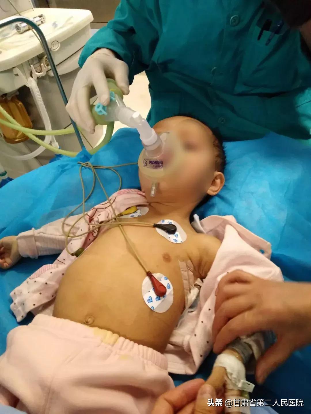 呼吸内科住院手术,呼吸内科手术