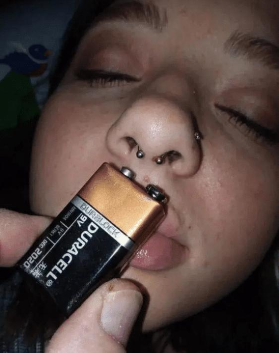 女朋友吵架被咬了打疫苗,被女朋友咬了需要打破伤风