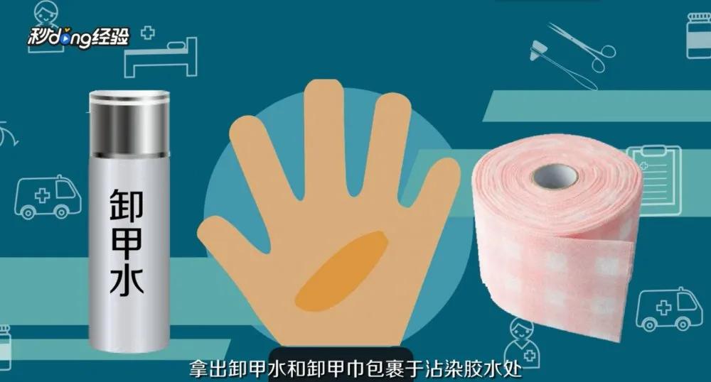 手指不小心被502胶水粘住了怎么办,手被502粘住求助消防员