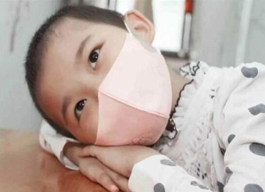 经常发热、流鼻血是白血病吗?冬季流鼻血主要是4类原因