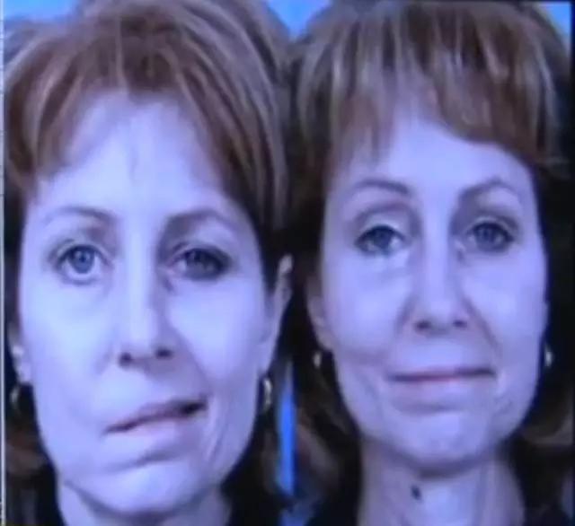 夏季贪凉引发空调病,夏日贪凉会有什么反应