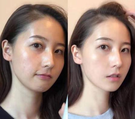 沈梦辰推荐祛痘好物,沈梦辰推荐的洗面奶有哪些