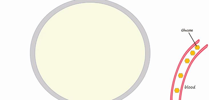 胰岛素是如何导致糖尿病的,胰岛素增多为什么会导致糖尿病