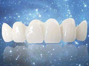 一般烤瓷牙与全瓷牙有什么区别,烤瓷牙和全瓷牙哪个性能更好