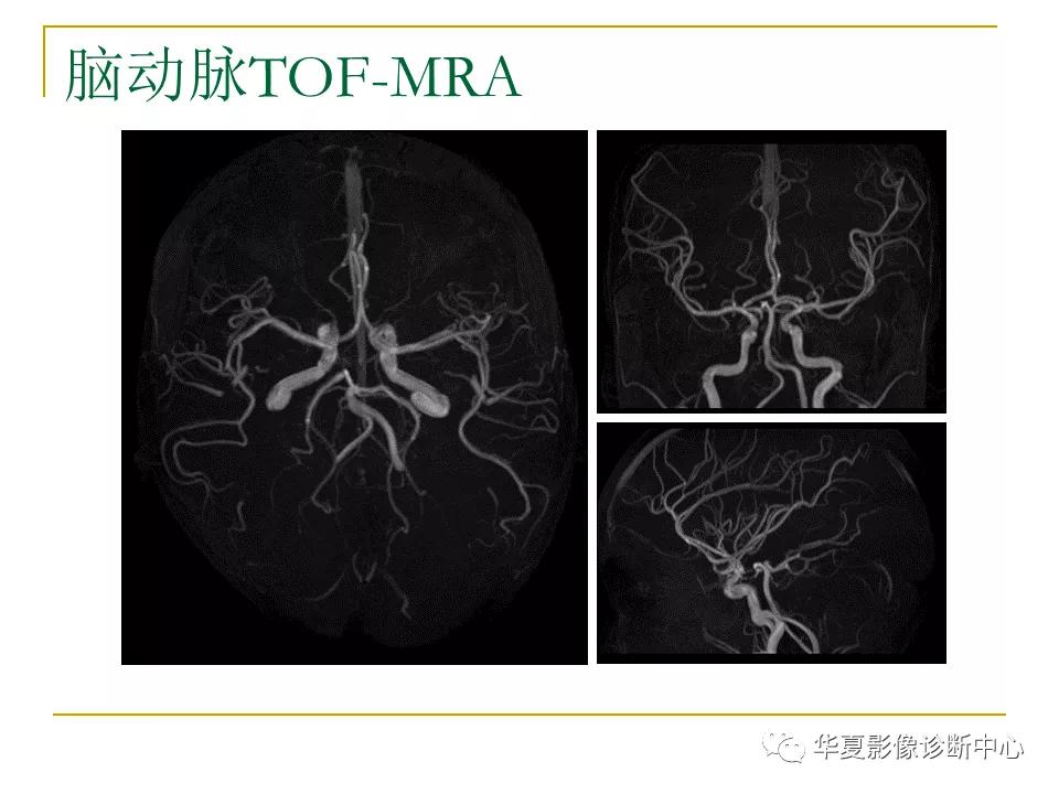 中国人脑立体定向mri应用解剖图谱,脑mri示意图