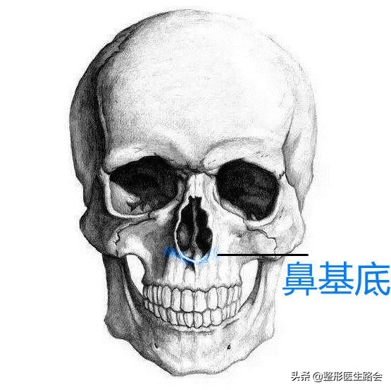 想做隆鼻的女孩,肋软骨填充鼻基底会拉长人中吗