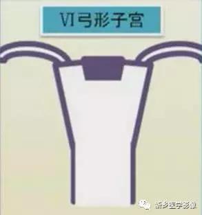 子宫发育异常,应想到的6大类常见畸形